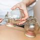 Cuppingtherapie