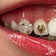 Full tooth