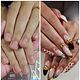 Nagelbijt Arrangement } 5 behandelingen € 1x elk 2 weken