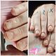 Nagelbijt Arrangement -10 weken,5 behandelingen -> 20% korting!