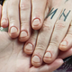 MAN-icure