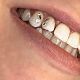 Tooth gems Desgins