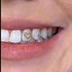 Tooth gems Gold