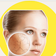 acne cleanup