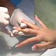 remove nail