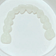 Pioneers Veneers / Single Arch