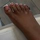 Toenail Overlay