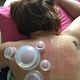 Cupping massage