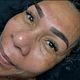 Brow treatment