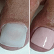 Gel nagels voet (Anti schimmel)