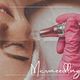 Microneedling + Higiene Facial