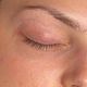 Lash Removal