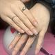 Nail fix