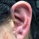 Anti-Tragus