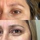 Microblading