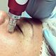 DERMAPEN