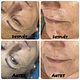 Galvanic spa