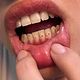 Gemmas dentales