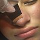 1 area extraction-White/Blackhead Extraction