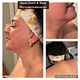 Neck/Back/Chest Microdermabrasion