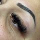 Brow lift