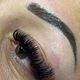 Brow lift