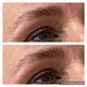 Eyebrow Treatments