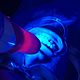 Teeth Whitening