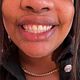 Glue Removal (Braces)