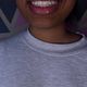 Braces Removal