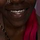 Top Or Bottom Braces