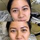 6-12 Week Touch Up