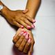 Gel overlay