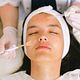 Peeling Chimic+Dermapen