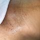 BRAZILLIAN WAXING