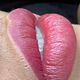 Microlips