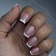NN-treatment + versteving / vorm correctie