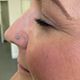 Nostril