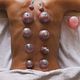 Cupping massage

Behandeling: Rug, Nek en schouders

Duur: 30 min