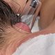 Wet Cupping
Behandeling: afhankelijk van u klacht.

Duur: 40 min