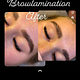 Browlamination+