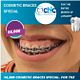 COSMETIC BRACES