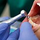 Professional Teeth Cleaning