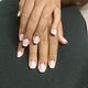Gel overlay