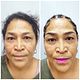 Microblading