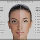 Chemical Peel