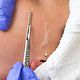 Dermaplaning