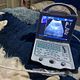 Pregnancy Scanning