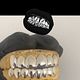 Grillz/Caps(dental)