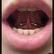 Tongue web piercing
